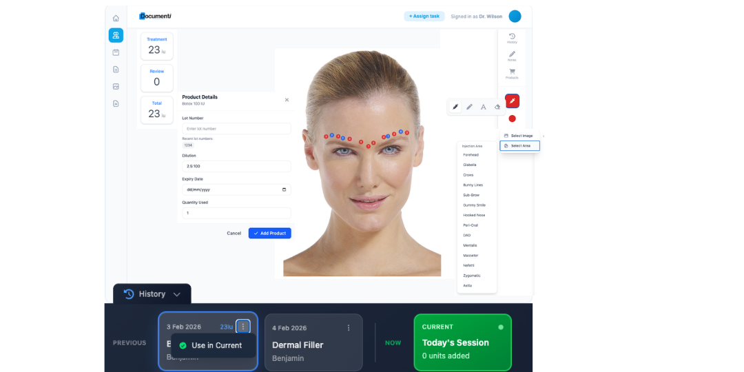 Documenti treatment map with injection points, product details panel, and treatment history timeline