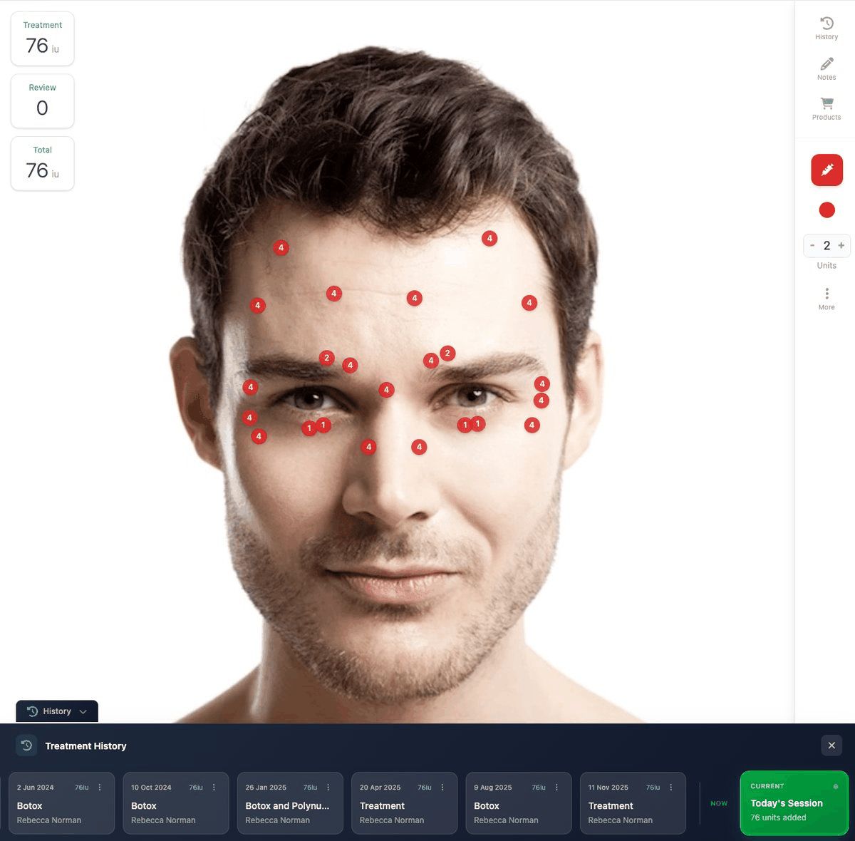 Intelligent treatment mapping with injection points